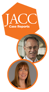 JACC: Case Reports
