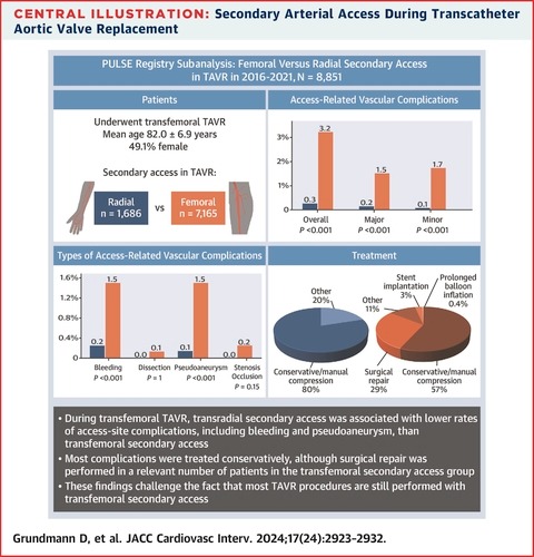Innovation in Catheter-Directed Therapy for Intermediate-High-Risk and High-Risk Pulmonary Embolism